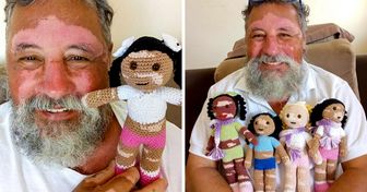 A Grandfather With Vitiligo Knits Dolls to Restore the Self-Esteem of Children Who Suffer From This Disease