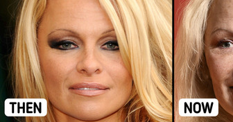 Pamela Anderson Dazzles at the Oscars Without Makeup and Sparks Debate, «Brush the Hair»