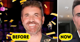“What Happened to His Face?!” Simon Cowell’s Drastic New Look Leaves Fans Worried