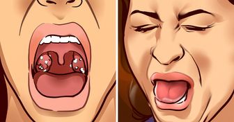 9 Things a Bad Taste in Your Mouth Is Trying to Tell You