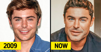 “I Almost Died,” Zac Efron Explains What Really Happened to His Face and Responds to Plastic Surgery Rumors