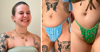 “You Don’t Have to Be Hairless to Wear a Bikini,” 2 Women Claim and a Debate Ensues