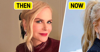 “Facelift Indicators Near Her Ears,” Nicole Kidman Shocks With Her Latest Transformation—People Notice One Detail