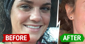 10 People Who Changed Their Skincare Routine and Took Their Glow to the Next Level