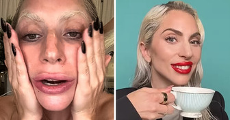 Lady Gaga Leaves Fans Baffled by Her Appearance