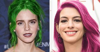 15 Celebrities That Would Look as Trendy as Ever With Unique Hair Colors