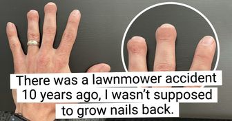 20 Times Life Was Spiced Up by Surprises No One Expected