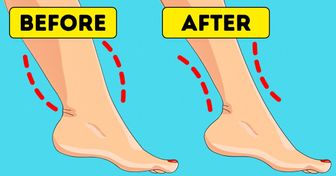 Why You Have Cankles and 7 Tips to Help You Deal With Them