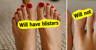 6 Foot-Saving Tricks That Can Help You Walk Without Blisters
