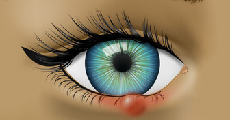 7 Things Your Eyes Are Trying To Tell You About Your Health