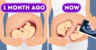 Some Women Can Get Pregnant When They’re Already Pregnant, and Here’s How It Happens