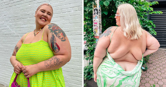 A Model Sharply Responds to People Criticizing Her Weight, «Back Fat Is Normal and Cute»