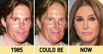 How 8 Celebrities Would Look If They Never Tried Modern Cosmetic Procedures