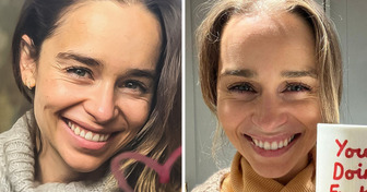 Emilia Clarke, 36, Gets Trolled for Her Aging Face in a Recent Selfie and Is Told to Use Fillers