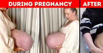 Mom’s Gigantic Baby Bump That Goes “Straight Out” Made People Think, “How Is That Actually Possible?”