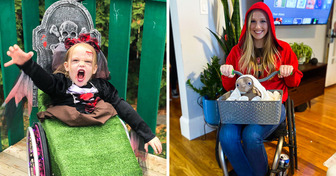 10 People Who Didn’t Let Their Disabilities Bring Down Their Halloween Spirit