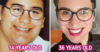 20 People That Have Gone Through a Huge Transformation With Age