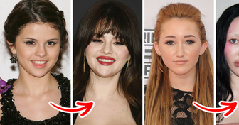What 13 Famous Women Looked Like Before They Made Their Lips Fuller