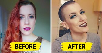 15 Women Who Went From Bald to Bold With Dazzling Charisma