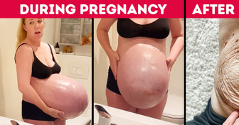 Mom Showed Her Pre-Birth Colossal Baby Bump, And People Doubt If It’s Even Possible