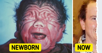 The Story of the Baby That Defied All Odds