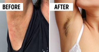 5 Positive Things That Will Happen to You If You Stop Shaving Your Body Right Now