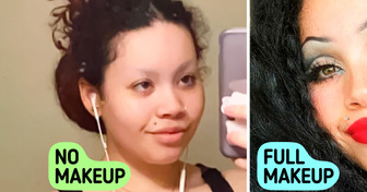 15 Pairs of Photos That Show Overwhelming Power of Change
