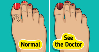 9 Things Your Feet Can Reveal About Your Health (That You Shouldn’t Ignore)