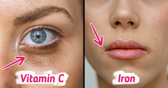 5 Nutrient Deficiencies in Women That Could Be Stealing Your Beauty