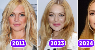 A Plastic Surgery Guru Explains Why Lindsay Lohan Looks So Different Now