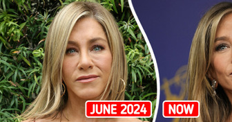 Jennifer Aniston Shocks Public With Her New Look, Fillers Officially Ditched