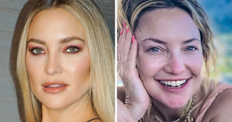 15+ Celebrities Who Flaunt Their Beauty Without a Drop of Makeup
