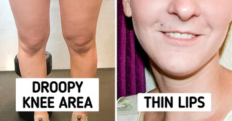 7 Body Features That Actually Are Nothing to Be Bothered About