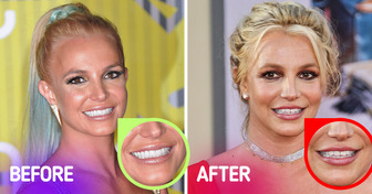 What Happened to Britney Spears: From Iconic Teeth Gap to Social Media Breaks