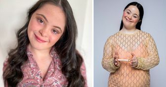 A Model With Down Syndrome Stars in Gucci Ads, and 10 More Campaigns That Embrace the Art of Being Yourself