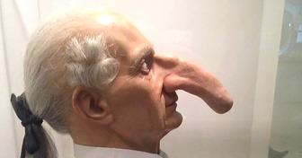 Meet Thomas Wedders, the Man Who Had the World’s Largest Nose and Became a Circus Sensation