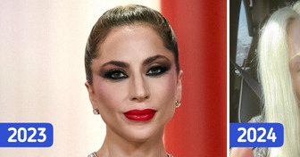 «She Doesn’t Look Like Herself Anymore,» Lady Gaga’s Latest Photo Causes a Stir