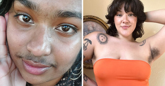15 Women Who Chose to Embrace Their Body Hair Over a Razor