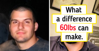 20 People Who’ve Changed So Much, You’d Think Time Itself Hit Fast Forward