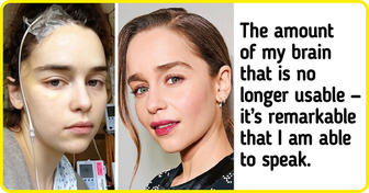 Emilia Clarke Honestly Shares Her Story About Losing a Part of Her Brain and Experiencing Awful Pain