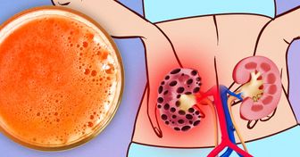 7 Popular Foods That Can Mess With Your Kidneys