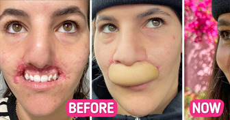 Model Lost Entire Lips in Pitbull Attack, And She Reflects on Her Recovering Journey