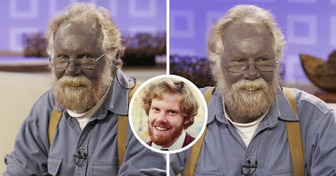 A Man Turned Blue After Years of Taking Dietary Supplements