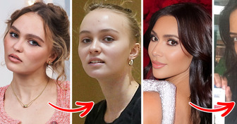 15 Confident Celebrities Who Showed Up Completely Makeup-Free