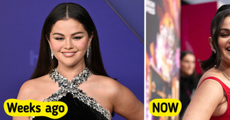 “What’s With the Arms?” One Detail About Selena Gomez’s New Look Creates Heavy Stir