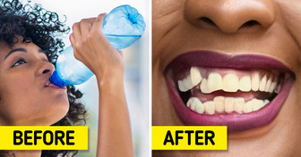 6 Ways You Might Be Causing Your Teeth to Stain