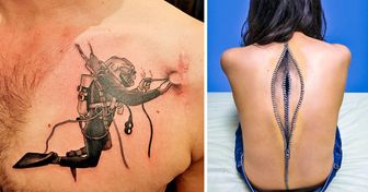 Tattoos Turn Scars That People Don’t Want to Hide Anymore Into Art