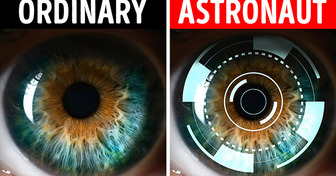 Human Eye Changes After 1 Year in Space, Here’s How