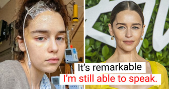 2 Brain Aneurysms Changed Emilia Clarke’s Life, and Now She Wants to Help Others