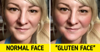 What May Happen to You If You Stop Eating Gluten Completely